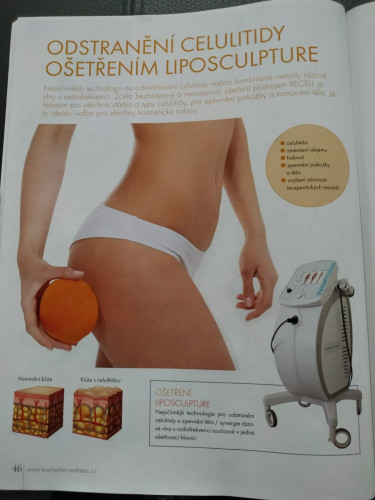 Odstránenie celulitídy ošetrením LIPOSCULPTURE: titulná fotka