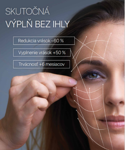 Phorma Beauty Laser 3.0 - Jedinečná výplň vrások bez použitia ihly: titulná fotka